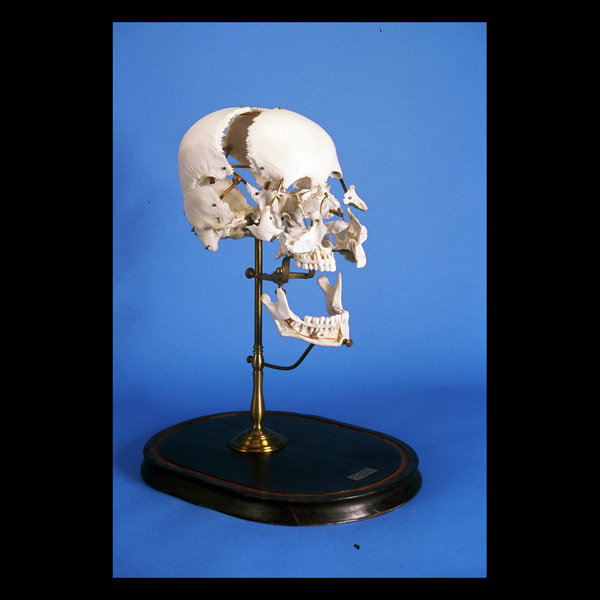 Cranio à Bauchène